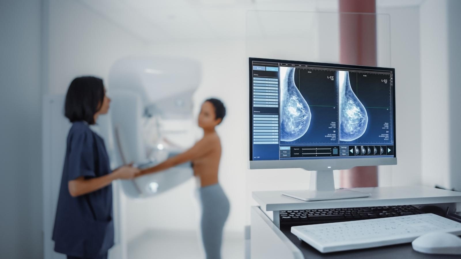 Mammography UCM Center