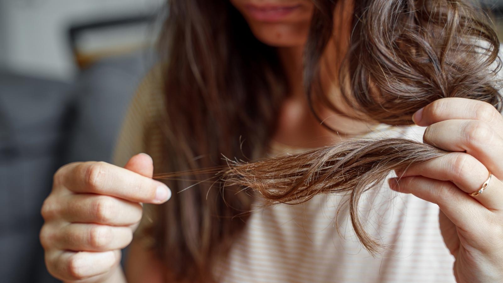 The origin of hair loss UCM Center
